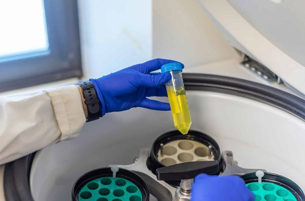 Quels sont les avantages d'une centrifugeuse par rapport à un extracteur de jus pour une cuisine saine ?